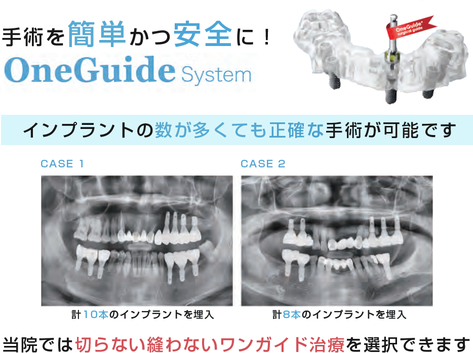 Oneguideシステム